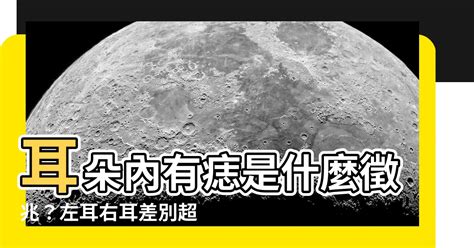 內痣是什麼|皮內痣：症狀、病因及如何治療